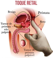 Novembro Azul alerta homens sobre exames preventivos do câncer